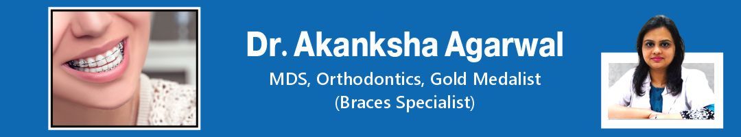 cost of braces in gurgaon